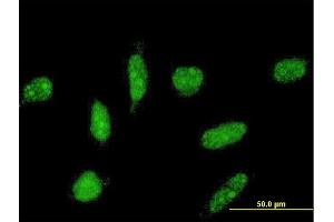 Immunofluorescence of monoclonal antibody to TOPORS on HeLa cell. (TOPORS Antikörper  (AA 98-205))