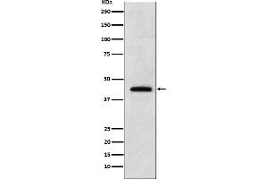 Western blot analysis of Renalase expression in 293T cell lysate.