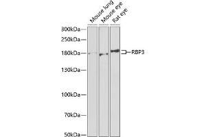 Western blot analysis of extracts of various cell lines, using RBP3 antibody (ABIN6129600, ABIN6146801, ABIN6146802 and ABIN6222034) at 1:1000 dilution. (RBP3 Antikörper  (AA 18-320))
