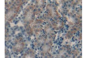 DAB staining on IHC-P; Samples: Mouse Kidney Tissue (CGA Antikörper  (AA 25-120))