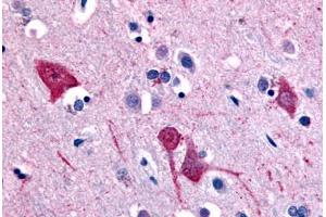 Human Brain, Cortex (formalin-fixed, paraffin-embedded) stained with SLC5A11 antibody ABIN213394 at 10 ug/ml followed by biotinylated goat anti-rabbit IgG secondary antibody ABIN481713, alkaline phosphatase-streptavidin and chromogen.