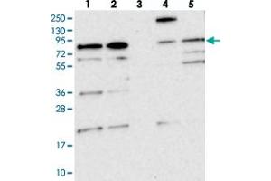 Western blot analysis of Lane 1: RT-4, Lane 2: U-251 MG, Lane 3: Human Plasma, Lane 4: Liver, Lane 5: Tonsil with KIAA1731 polyclonal antibody  at 1:250-1:500 dilution.
