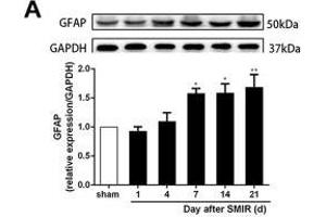 Astrocytes were activated and mainly expressed as the A1 phenotype in the spinal cord after SMIR. (GAPDH Antikörper)