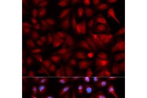 Immunofluorescence analysis of U2OS cells using PSMB5 Polyclonal Antibody (PSMB5 Antikörper)