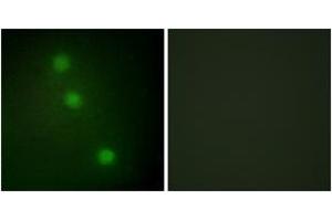 Immunofluorescence analysis of HuvEc cells, using ATF1 Antibody. (AFT1 Antikörper  (AA 176-225))