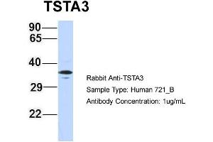 Host: Rabbit Target Name: TSTA3 Sample Type: 721_B Antibody Dilution: 1. (TSTA3 Antikörper  (N-Term))