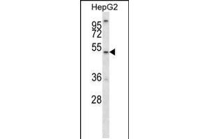 Western blot analysis in HepG2 cell line lysates (35ug/lane). (ALG11 Antikörper  (C-Term))