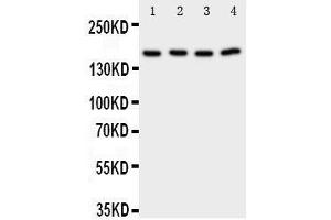 Anti-Phospholipase A2 antibody, Western blotting Lane 1: Rat Testis Tissue Lysate Lane 2: Rat Brain Tissue Lysate Lane 3: A549 Cell Lysate Lane 4: COLO320 Cell Lysate (PLA2G4A Antikörper  (C-Term))
