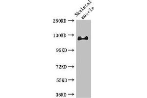 Western Blot Positive WB detected in: Mouse skeletal muscle tissue All lanes: RBL1 antibody at 3 μg/mL Secondary Goat polyclonal to rabbit IgG at 1/50000 dilution Predicted band size: 121, 115 kDa Observed band size: 121 kDa (p107 Antikörper  (AA 201-500))