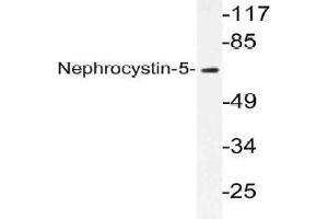 Western blot (WB) analysis of Nephrocystin-5 antibody in extracts from K562 cells. (IQCB1 Antikörper)