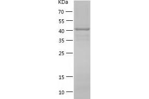 Western Blotting (WB) image for KIN, Antigenic Determinant of RecA Protein Homolog (KIN) (AA 1-393) protein (His tag) (ABIN7123689)
