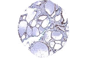 Thyroid gland Strong membranous CDH16 staining of follicle cells CDH16 immunohistochemistry (Rekombinanter Cadherin-16 Antikörper)