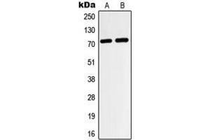 Western blot analysis of HIF3 alpha expression in HeLa (A), HepG2 (B) whole cell lysates. (HIF3A Antikörper  (Center))