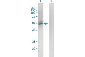 Western Blot analysis of ACMSD expression in transfected 293T cell line by ACMSD monoclonal antibody (M01), clone 3A9. (ACMSD Antikörper  (AA 179-278))
