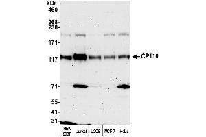 anti-Centriolar Coiled Coil Protein 110kDa (CCP110) (AA 575-625) antibody