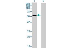 Western Blot analysis of IGSF21 expression in transfected 293T cell line by IGSF21 MaxPab polyclonal antibody.