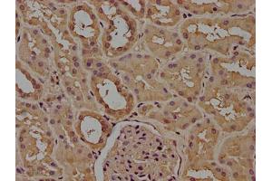 Immunohistochemistry (IHC) image for anti-CD14 (CD14) (AA 20-345) antibody (ABIN7160185)