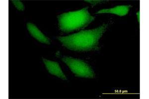 Immunofluorescence of purified MaxPab antibody to CDKN2C on HeLa cell. (CDKN2C Antikörper  (AA 1-168))