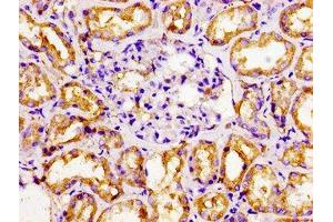 Immunohistochemistry (IHC) image for anti-Nuclear Receptor Subfamily 2, Group F, Member 6 (NR2F6) (AA 6-194) antibody (ABIN7161906)