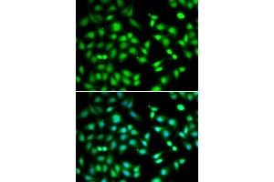 Immunofluorescence analysis of HeLa cells using CDKN2D antibody (ABIN5973935). (CDKN2D Antikörper)