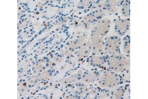 IHC-P analysis of stomach tissue, with DAB staining. (LOR Antikörper  (AA 210-295))