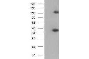 Western Blotting (WB) image for anti-Zinc Finger Protein 36, C3H Type, Homolog (Mouse) (ZFP36) antibody (ABIN1501404) (ZFP36 Antikörper)