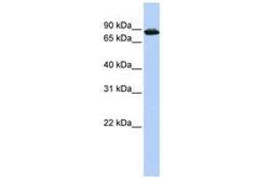 Image no. 1 for anti-HIV-1 Tat Specific Factor 1 (HTATSF1) (AA 612-661) antibody (ABIN6744230) (HTATSF1 Antikörper  (AA 612-661))