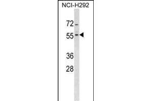 ZN Antibody (Center) (ABIN1537992 and ABIN2849203) western blot analysis in NCI- cell line lysates (35 μg/lane). (ZNF200 Antikörper  (AA 187-214))