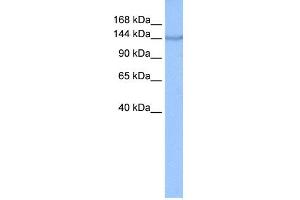 WB Suggested Anti-COPA Antibody Titration: 0. (COPA Antikörper  (N-Term))