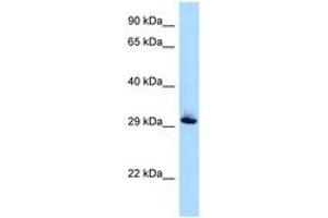 Image no. 1 for anti-RAB33B, Member RAS Oncogene Family (RAB33B) (AA 80-129) antibody (ABIN6747936) (RAB33B Antikörper  (AA 80-129))