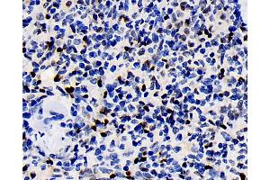 Immunohistochemistry analysis of paraffin-embedded rat spleen using ERK 2 Polyclonal Antibody at dilution of 1:100. (ERK2 Antikörper)