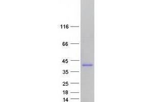 Western Blotting (WB) image for Alport Syndrome, Mental Retardation, Midface Hypoplasia and Elliptocytosis Chromosomal Region Gene 1 (AMMECR1) (Transcript Variant 1) protein (Myc-DYKDDDDK Tag) (ABIN2714664)