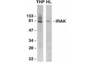 Image no. 1 for anti-Interleukin-1 Receptor-Associated Kinase 1 (IRAK1) (C-Term) antibody (ABIN201163) (IRAK1 Antikörper  (C-Term))