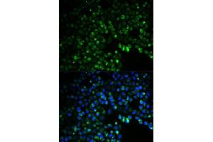 Immunofluorescence analysis of HeLa cells using UGDH antibody. (UGDH Antikörper  (AA 165-494))