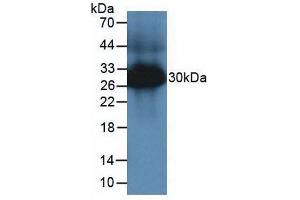 Western blot analysis of Mouse Large Intestine Tissue. (TPSAB1 Antikörper  (AA 149-273))