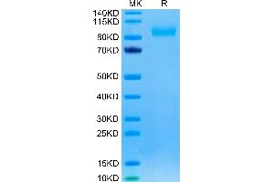 SDS-PAGE (SDS) image for Epidermal Growth Factor Receptor (EGFR) (AA 25-645) protein (His tag) (ABIN7274521)