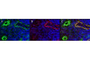 Immunohistochemistry detection of endogenous LYVE-1 in cryo sections of human colon carcinoma using anti-LYVE-1 (human), pAb  (red) and anti-human CD31 pAb (green). (LYVE1 Antikörper  (AA 24-232))