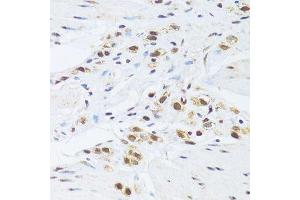 Immunohistochemistry of paraffin-embedded human stomach using GABPB1 Antibody. (GABPB1 Antikörper  (AA 231-395))