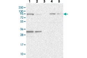 Western blot analysis of Lane 1: RT-4, Lane 2: U-251 MG, Lane 3: Human Plasma, Lane 4: Liver, Lane 5: Tonsil with FCHO2 polyclonal antibody . (FCHO2 Antikörper)