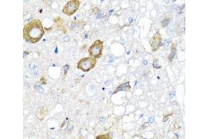 Immunohistochemistry of paraffin-embedded Rat brain using MGP Polyclonal Antibody at dilution of 1:100 (40x lens). (MGP Antikörper)