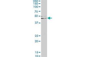 LEFTY1 monoclonal antibody (M03), clone 2E10. (LEFTY1 Antikörper  (AA 1-366))