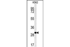 Western blot analysis of C3orf75 Antibody in K562 cell line lysates (35ug/lane)