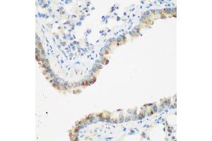 Immunohistochemistry of paraffin-embedded mouse lung using IGF2BP3 antibody at dilution of 1:200 (40x lens).