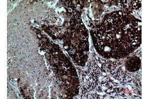 Immunohistochemistry (IHC) analysis of paraffin-embedded Human Lung, antibody was diluted at 1:100. (ITGAD Antikörper  (Internal Region))