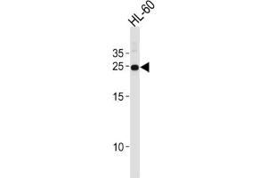 Western Blotting (WB) image for anti-Homeobox A6 (HOXA6) antibody (ABIN2996495) (HOXA6 Antikörper)