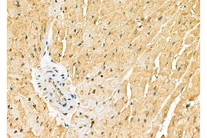 ABIN6265896 and ABIN6278125 at 1/100 staining Rat heart tissue by IHC-P. (UNG Antikörper  (Internal Region))