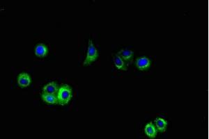 Immunofluorescent analysis of HepG2 cells using ABIN7144042 at dilution of 1:100 and Alexa Fluor 488-congugated AffiniPure Goat Anti-Rabbit IgG(H+L) (APP Antikörper  (AA 18-270))