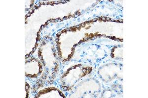 Immunohistochemistry of paraffin-embedded rat kidney using OAT Rabbit pAb (ABIN6127442, ABIN6144985, ABIN6144986 and ABIN6221831) at dilution of 1:150 (40x lens). (OAT Antikörper  (AA 160-439))