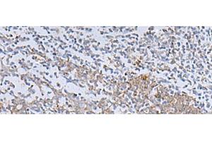 Immunohistochemistry of paraffin-embedded Human tonsil tissue using IL22RA2 Polyclonal Antibody at dilution of 1:70(x200) (IL22RA2 Antikörper)