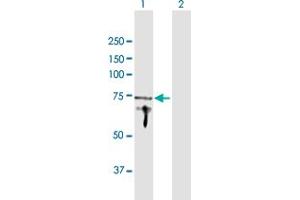 Western Blotting (WB) image for anti-Adaptor Protein, phosphotyrosine Interaction, PH Domain and Leucine Zipper Containing 1 (APPL1) (AA 1-709) antibody (ABIN949173)